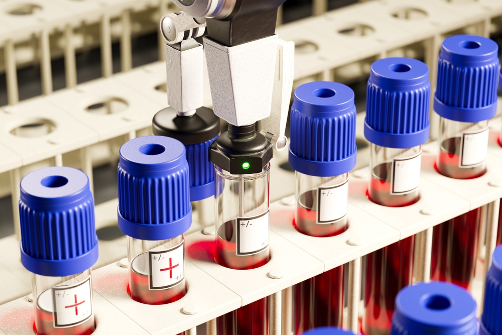 GS High precision automated blood testing equipment in action shutterstock 2434768195